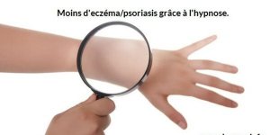 L’hypnose un traitement complémentaire pour limiter/atténuer le psoriasis/l’eczéma